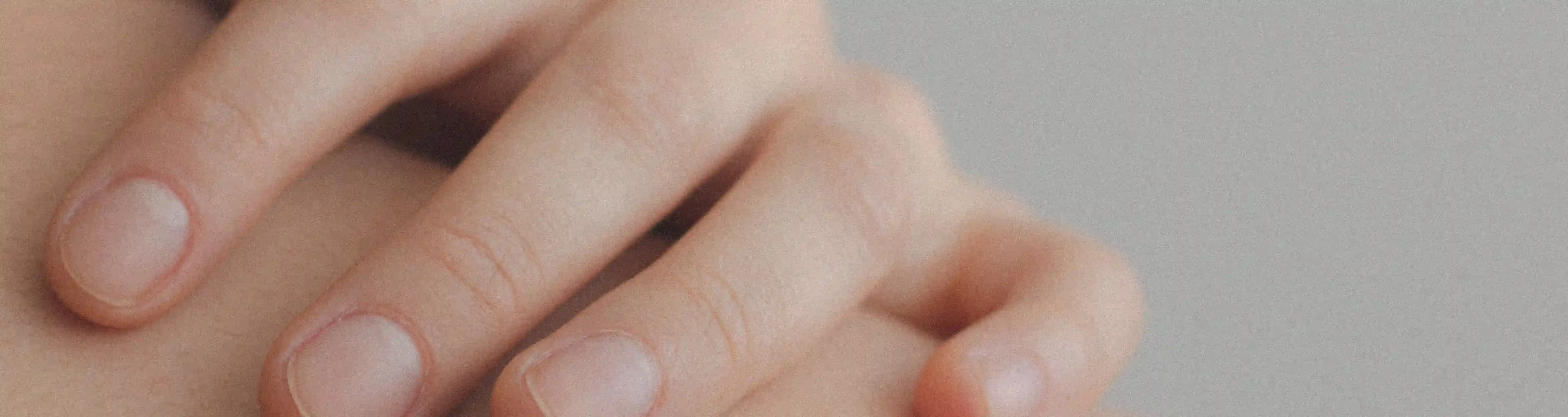 Penyakit Kulit & Subkutan