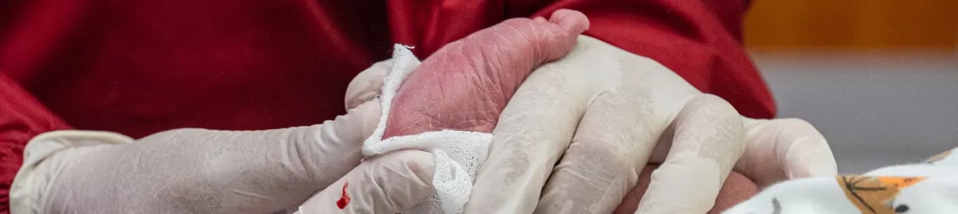 Skrining Hiperlasia Adrenal Kongenital (S-HAK)